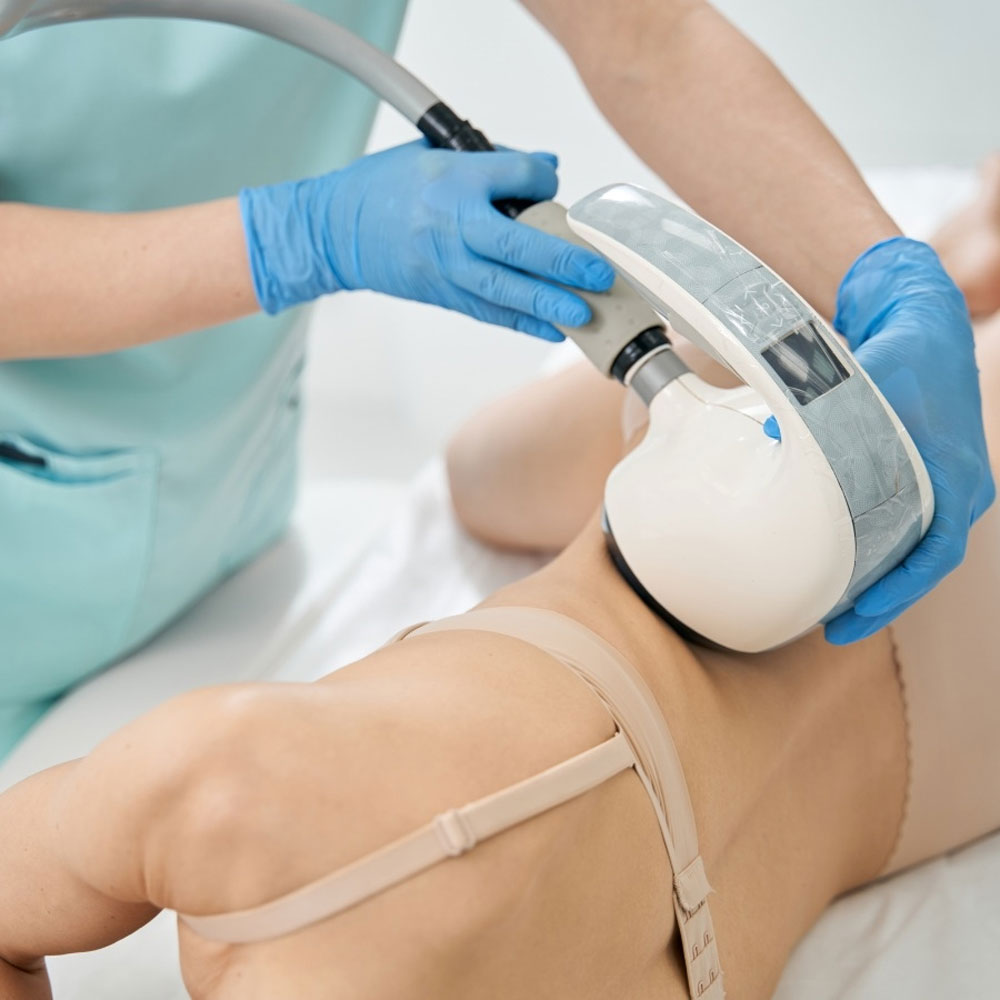 VelaShape™
